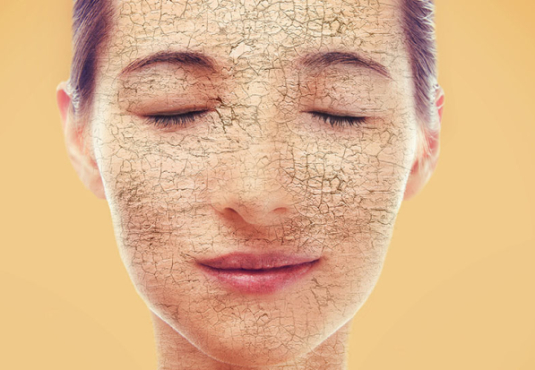 Dry skin: causes and ways to overcome it Dry skin: causes and ways to overcome it