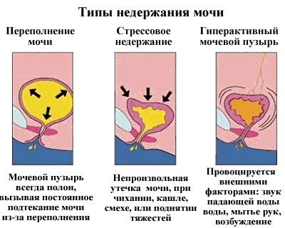 My default image
