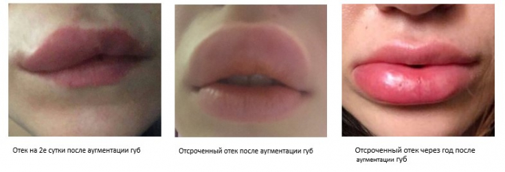 My default image
