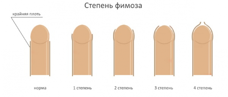 My default image
