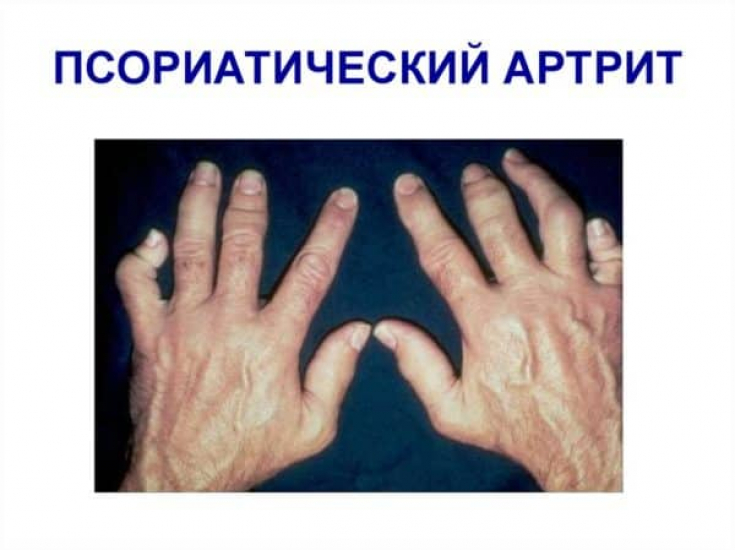 My default image