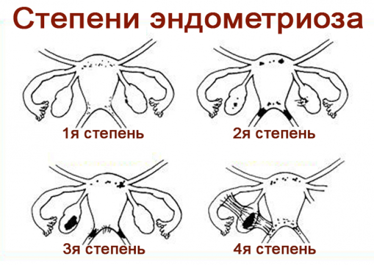 My default image