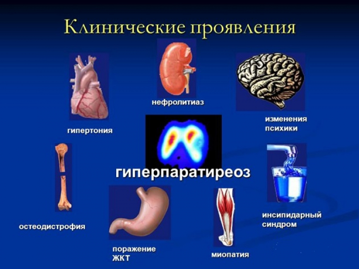 My default image