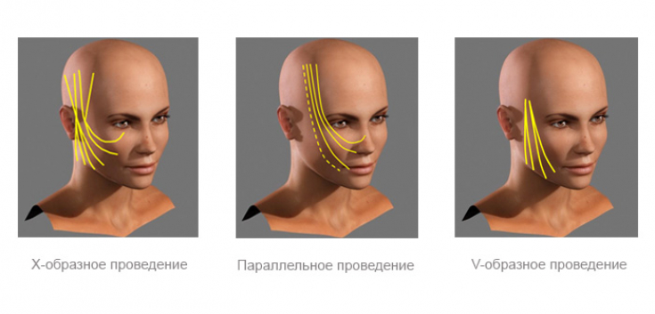 My default image