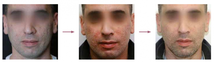 My default image