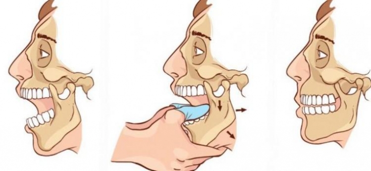 My default image