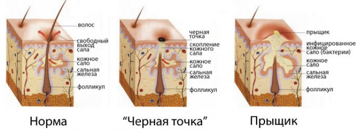 My default image