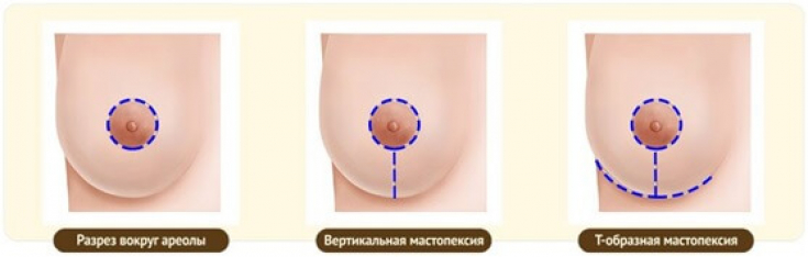 My default image