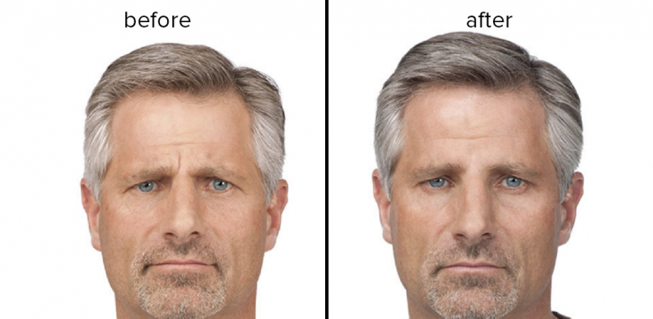 My default image