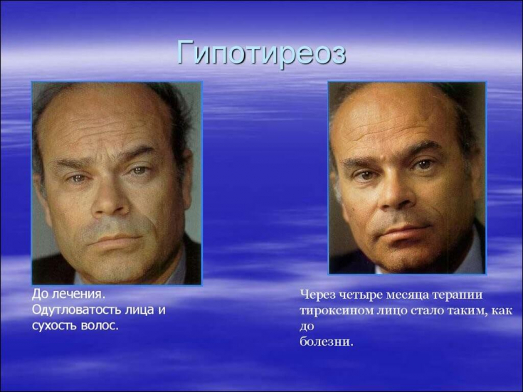 My default image