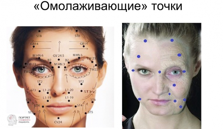 My default image