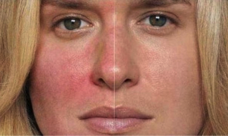 My default image