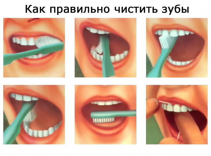My default image
