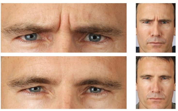 My default image