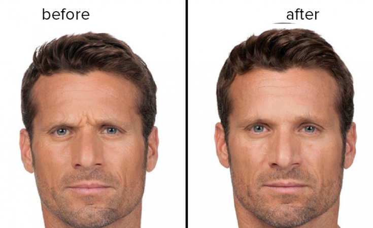 My default image