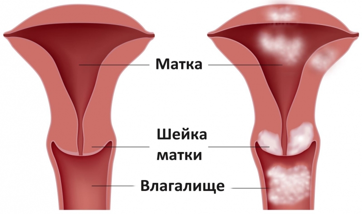 My default image