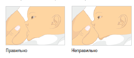 My default image