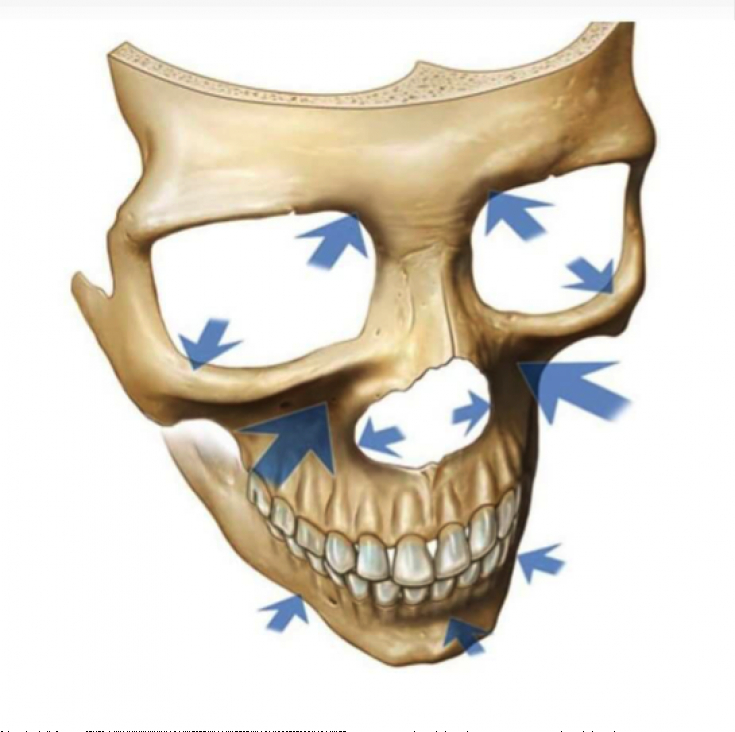 My default image
