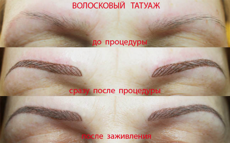 My default image
