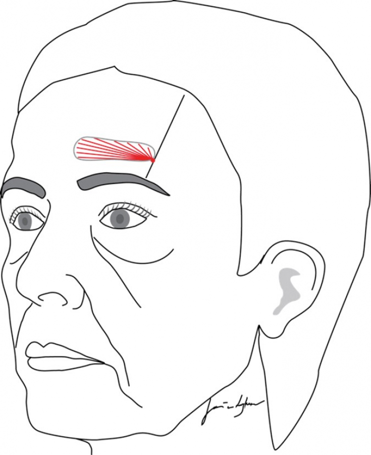 My default image