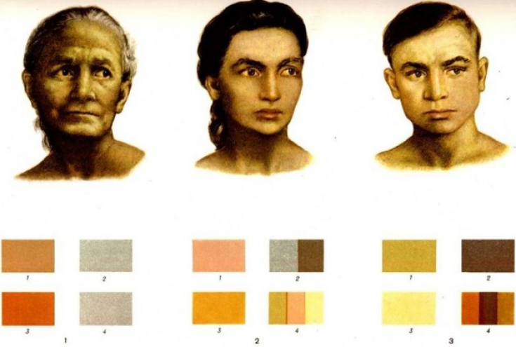 желтый цвет кожи тела