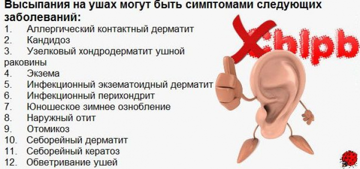 My default image