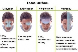 10-proverennykh-sposobov-kotorye-izbavyat-ot-golovnoj-boli-a-takzhe-ot-boli-v-spine-i-sustavakh