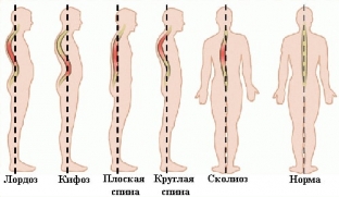 3-argumenta-kotorye-zastavyat-vas-vypryamit-spinu-pryamo-sejchas