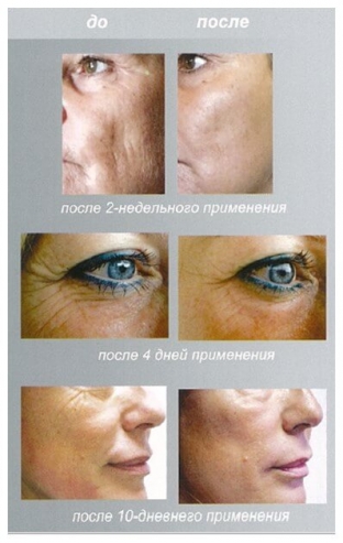 9-prichin-vybrat-peptidnuyu-kosmetiku-evenswiss-dlya-domashnego-ukhoda