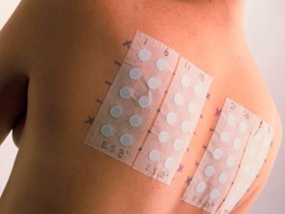 allergicheskie-pyatna-vidy-simptomy-lechenie