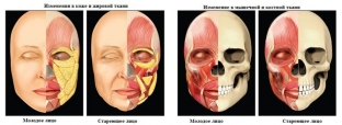 anatomiya-stareniya-litsa-kuda-ukhodit-molodost-i-kak-ee-vernut