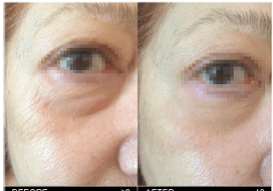 anti-age-terapiya-iddna-skin-care-sekret-molodosti-kozhi-v-vashikh-genakh