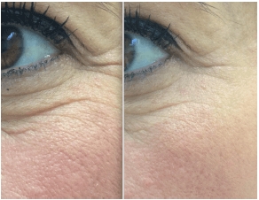 anti-age-terapiya-iddna-skin-care-sekret-molodosti-kozhi-v-vashikh-genakh