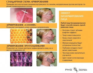 bioarmirovanie-litsa-trebuet-chetkogo-algoritma-dejstvij