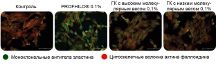 bioremodelirovanie-profhilo-kak-estestvennyj-protsess-omolozheniya-kozhi