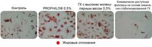 bioremodelirovanie-profhilo-kak-estestvennyj-protsess-omolozheniya-kozhi