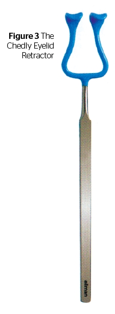 blefaroplastika-radiovolnovym-metodom-snizhaet-travmatizatsiyu-vek