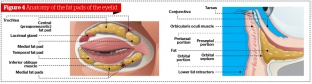 blefaroplastika-radiovolnovym-metodom-snizhaet-travmatizatsiyu-vek