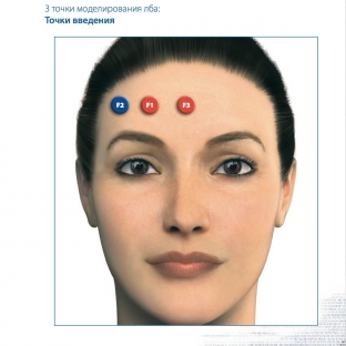 bystro-i-effektivno-protsedura-korrektsii-lba-fillerami-juv-derm