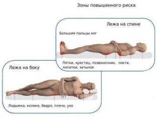 chem-opasny-prolezhni-i-kak-predupredit-ikh-poyavlenie