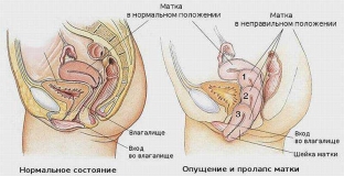 chto-proiskhodit-s-organizmom-zhenshchiny-v-periode-postmenopauzy