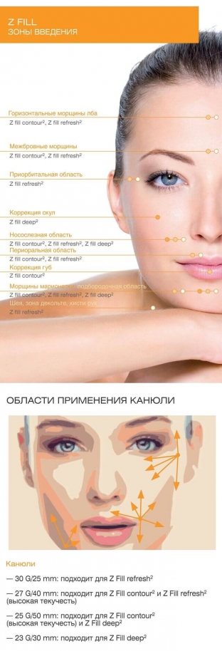 dermalnye-fillery-novogo-pokoleniya-z-fill