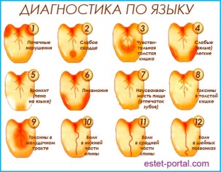 diagnostika-boleznej-po-yazyku-kak-vyyavit-nedug