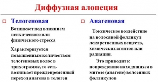 diffuznaya-alopetsiya-pochemu-trudno-lechitsya