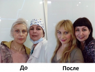 effektivnoe-omolozhenie-posle-50-let-kombinatsiya-anti-age-protsedur