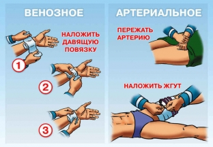 kak-pravilno-okazyvat-pervuyu-pomoshch-pri-krovotecheniyakh