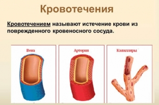 kak-pravilno-okazyvat-pervuyu-pomoshch-pri-krovotecheniyakh