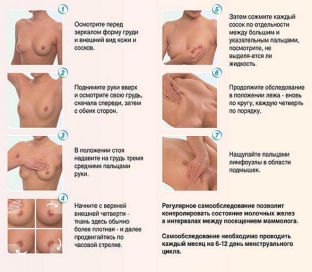 kak-provesti-samostoyatelnoe-obsledovanie-i-vyyavit-priznaki-mastopatii-molochnoj-zhelezy