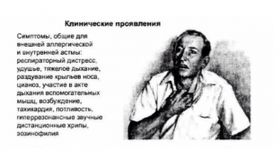 kakie-simptomy-bronkhialnoj-astmy-pomogut-s-pervykh-minut-uznat-zabolevanie
