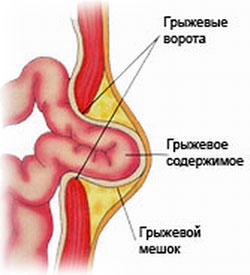 kakimi-oslozhneniyami-mogut-grozit-gryzhi-zhivota